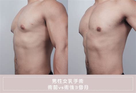 男生看胸部|男生為什麼會愛「女性胸部」？不只是因為性慾，最美博士揭驚人。